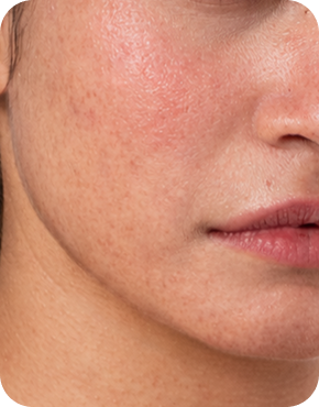 Before skin comparison